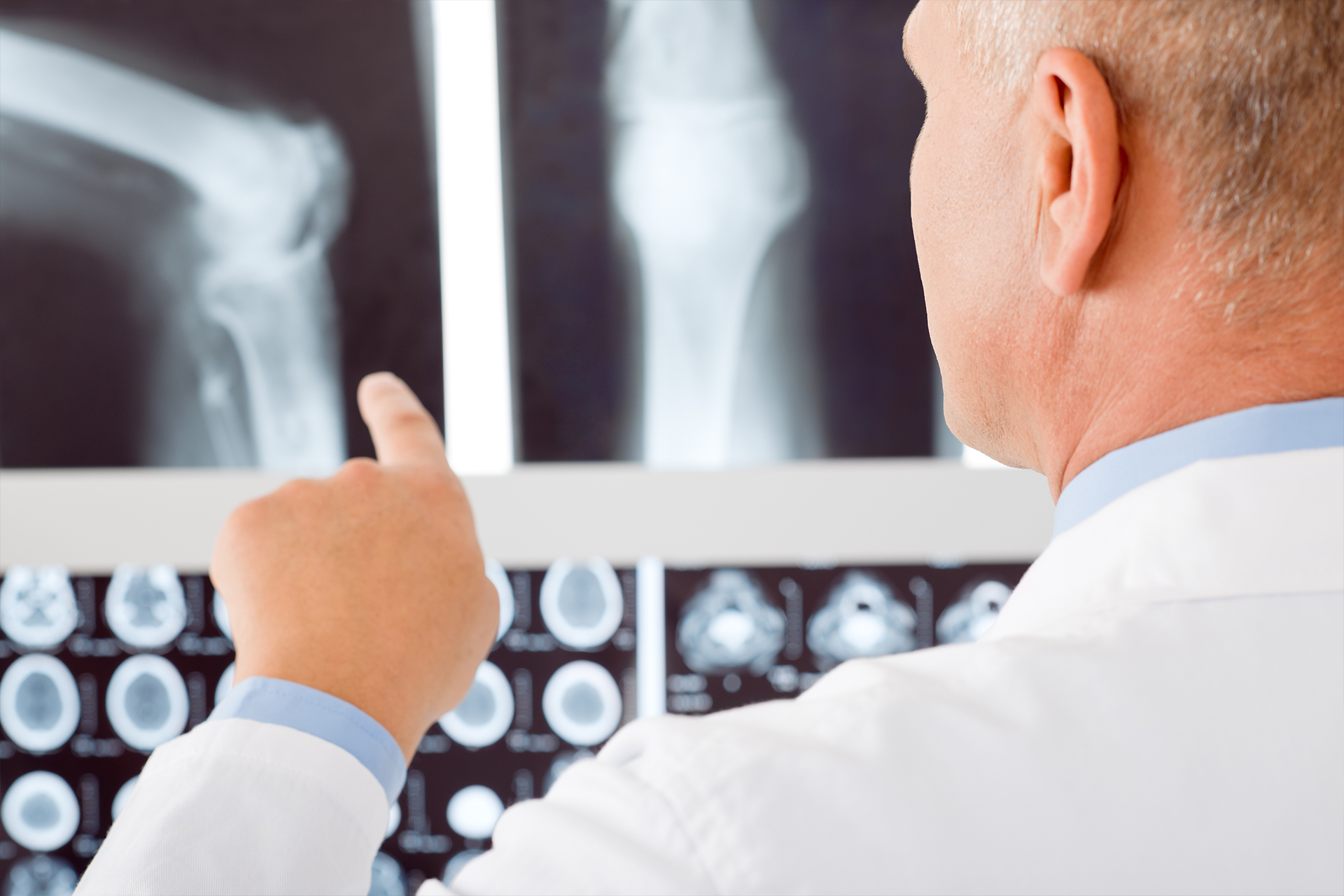 Un medico controlla lo stato delle ossa affette da osteoporosi