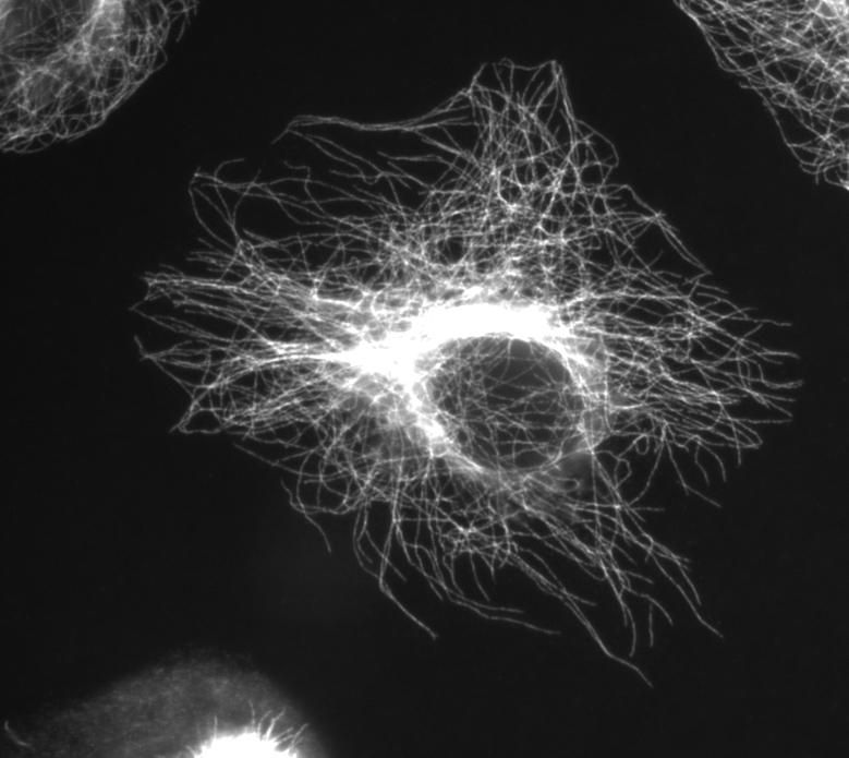 Colorazione dei microtubuli in una cellula fissata con anticorpi anti-beta-tubulina