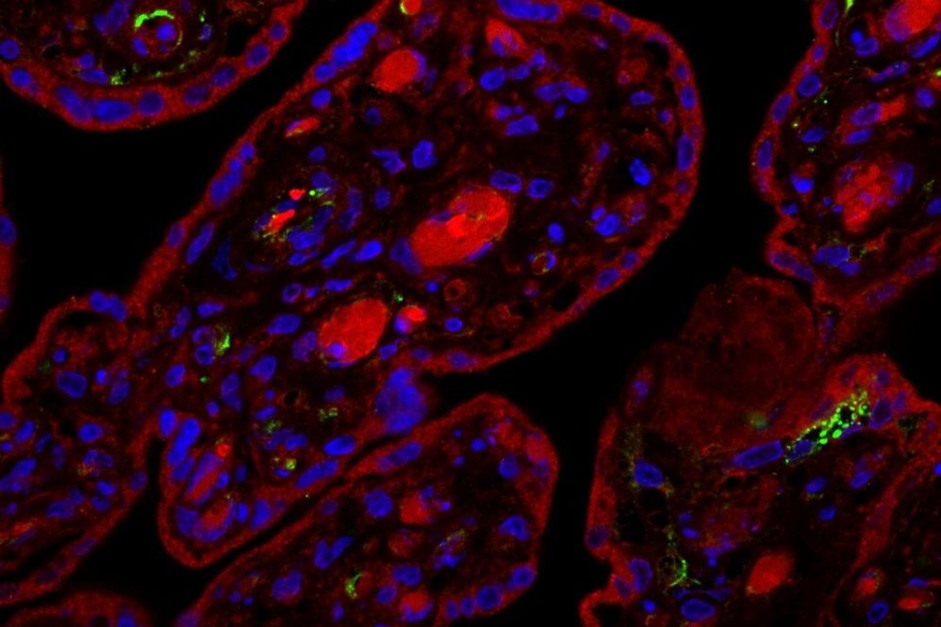 Sezione di placenta umana infettata con SARS-CoV-2 e analizzata 24 ore dopo l'infezione: il segnale verde indica la presenza della proteina virale Spike e il segnale blu i nuclei delle cellule nel tessuto placentare