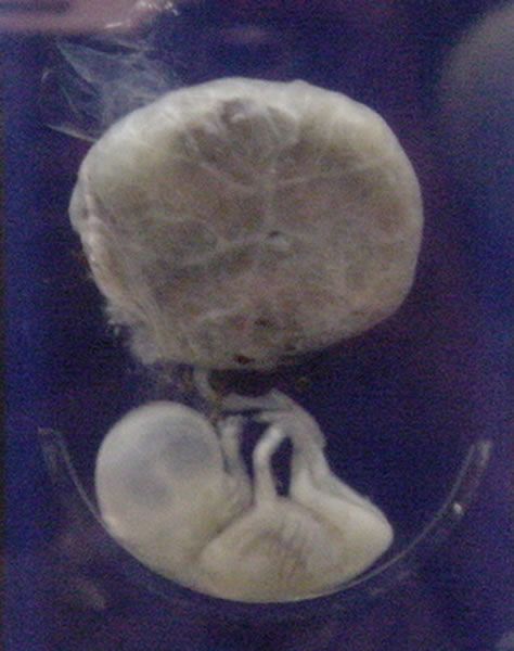 Un feto umano di tre mesi collegato alla placenta