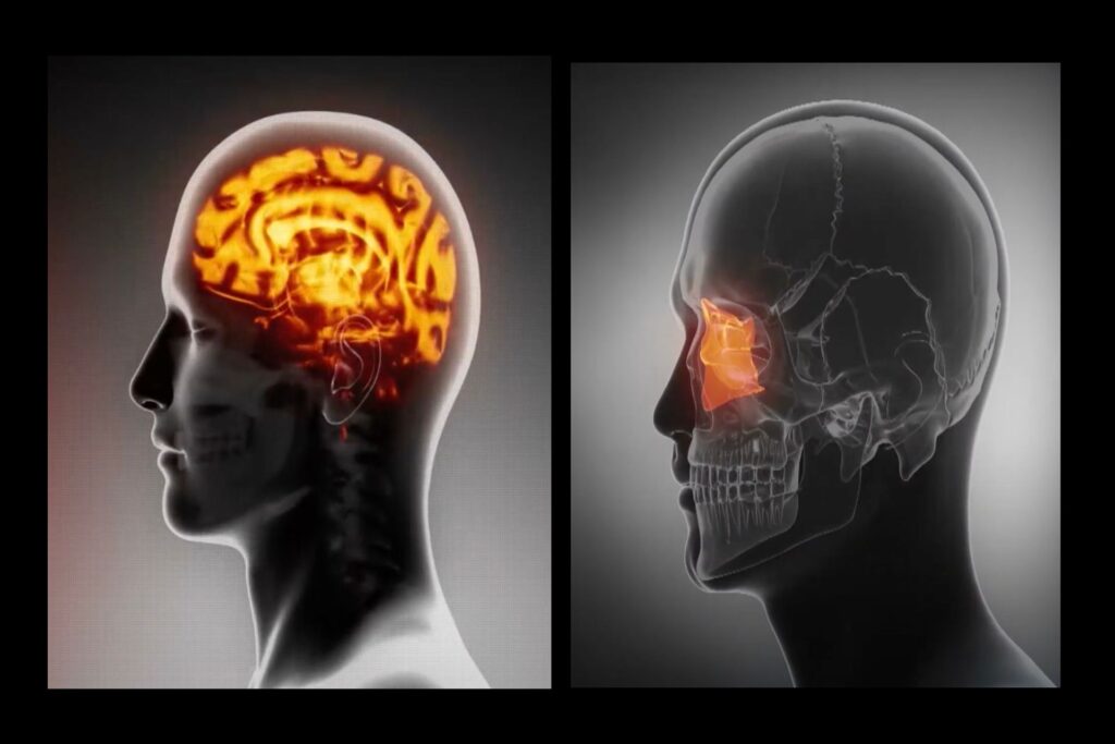 يتم تمييز الدماغ البشري ومنطقة الصفيحة الكريبروزا باللون البرتقالي
