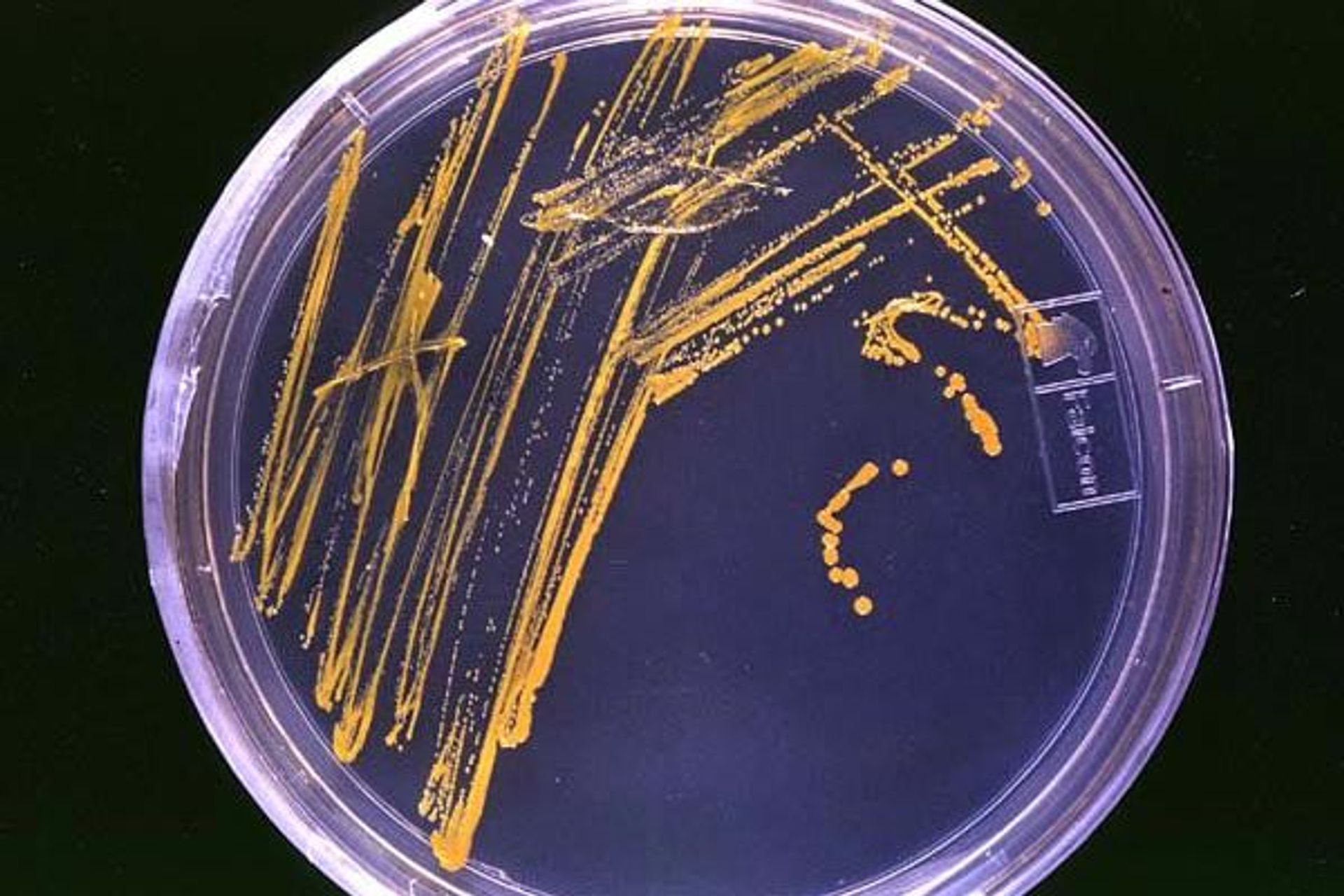 La capsula di Petri prende il nome dal batteriologo Julius Richard Petri, assistente di Robert Koch, che la inventò nel 1877, ed è un recipiente piatto di vetro o plastica, solitamente di forma cilindrica, che ha un diametro tra i 50 e i 100 millimetri e un'altezza di 15 mm: è un importante strumento di lavoro in molti campi della biologia, per la crescita di colture cellulari e perché permette di osservare a occhio nudo colonie batteriche