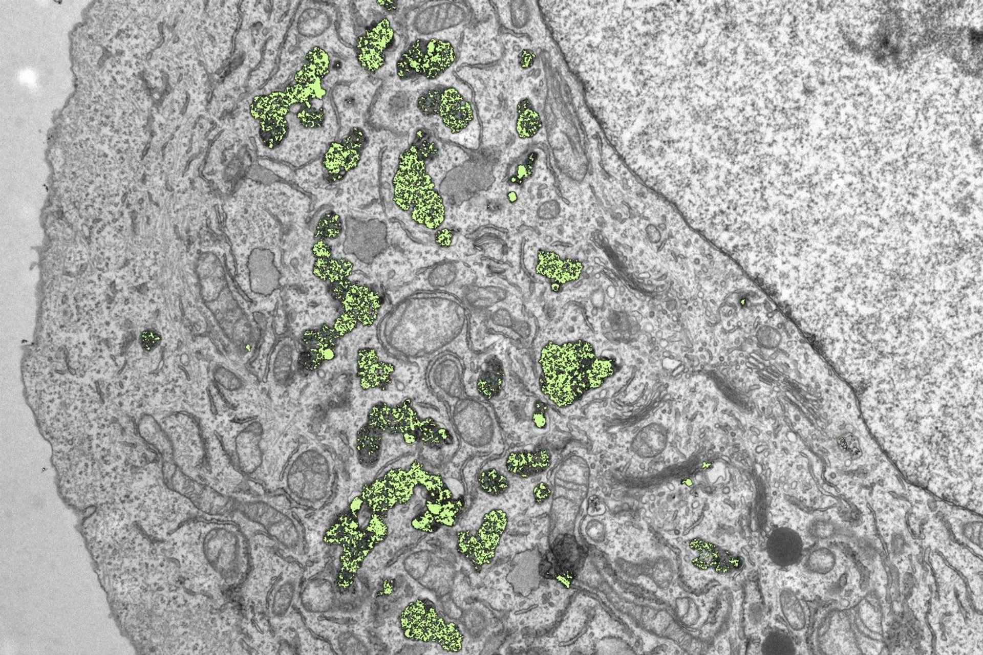 Le nanoparticelle di diossido di afnio, evidenziate dal colore giallo, si insinuano all’interno di una cellula, accumulandosi nei tessuti tumorali e causando loro seri danni dopo l'irradiazione (Foto EMPA/Politecnico Federale di Zurigo)