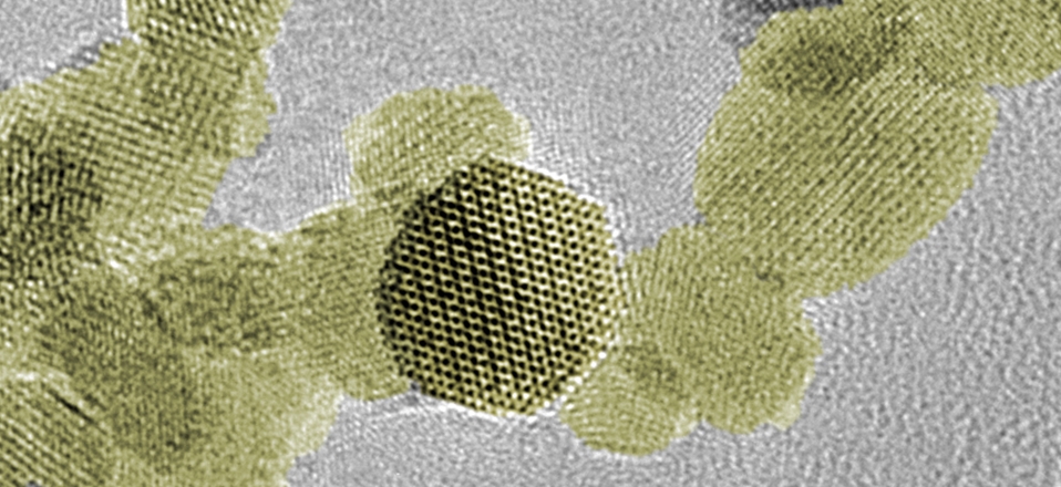 Le nanoparticelle di diossido di afnio, evidenziate dal colore giallo, si insinuano all’interno di una cellula, accumulandosi nei tessuti tumorali e causando loro seri danni dopo l'irradiazione (Foto EMPA/Politecnico Federale di Zurigo)