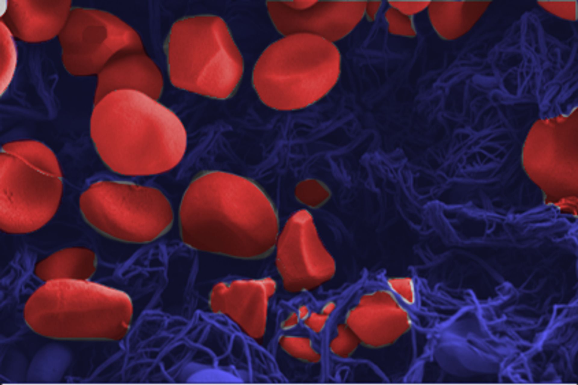 Al centro di un coagulo di sangue con il microscopio elettronico a scansione è possibile visualizzare chiaramente i globuli rossi con un diametro di pochi micrometri (Foto: EMPA)