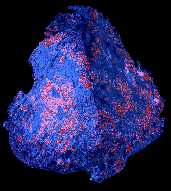 Un’immagine di crudele bellezza un coagulo di sangue largo circa 1,5 millimetri in un'immagine di tomografia microcomputerizzata tridimensionale (Foto: EMPA)
