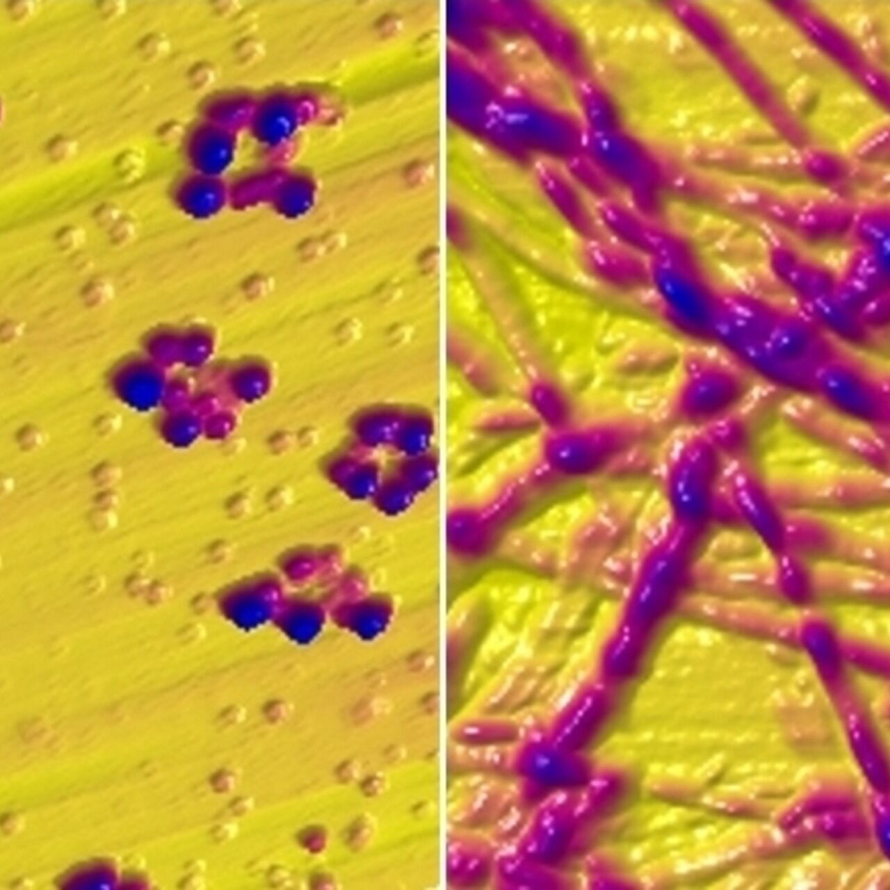 Fibrille di alfa-sinucleina prima o dopo il contatto con il rame