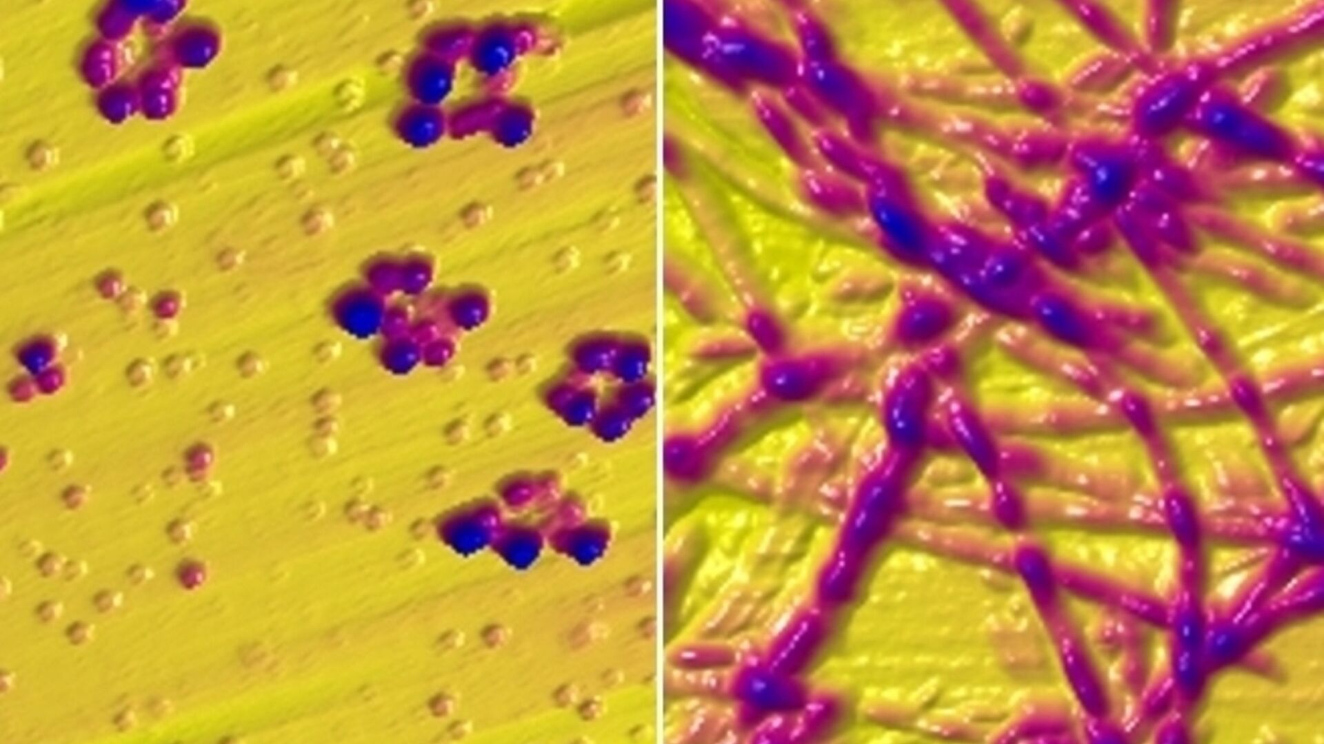 Fibrille di alfa-sinucleina prima o dopo il contatto con il rame