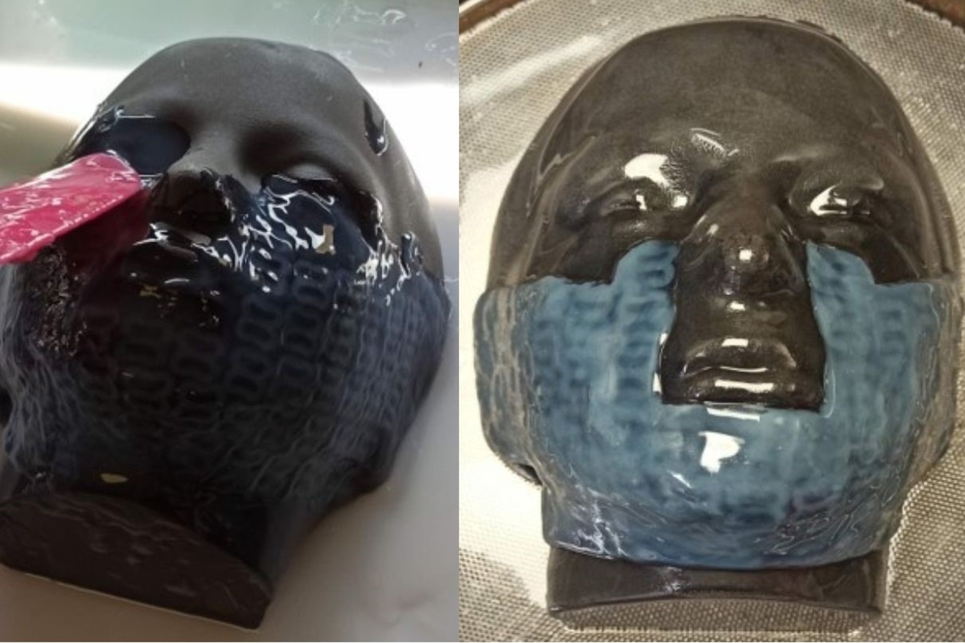 Le innovative maschere facciali 3D per le ustioni dei bambini