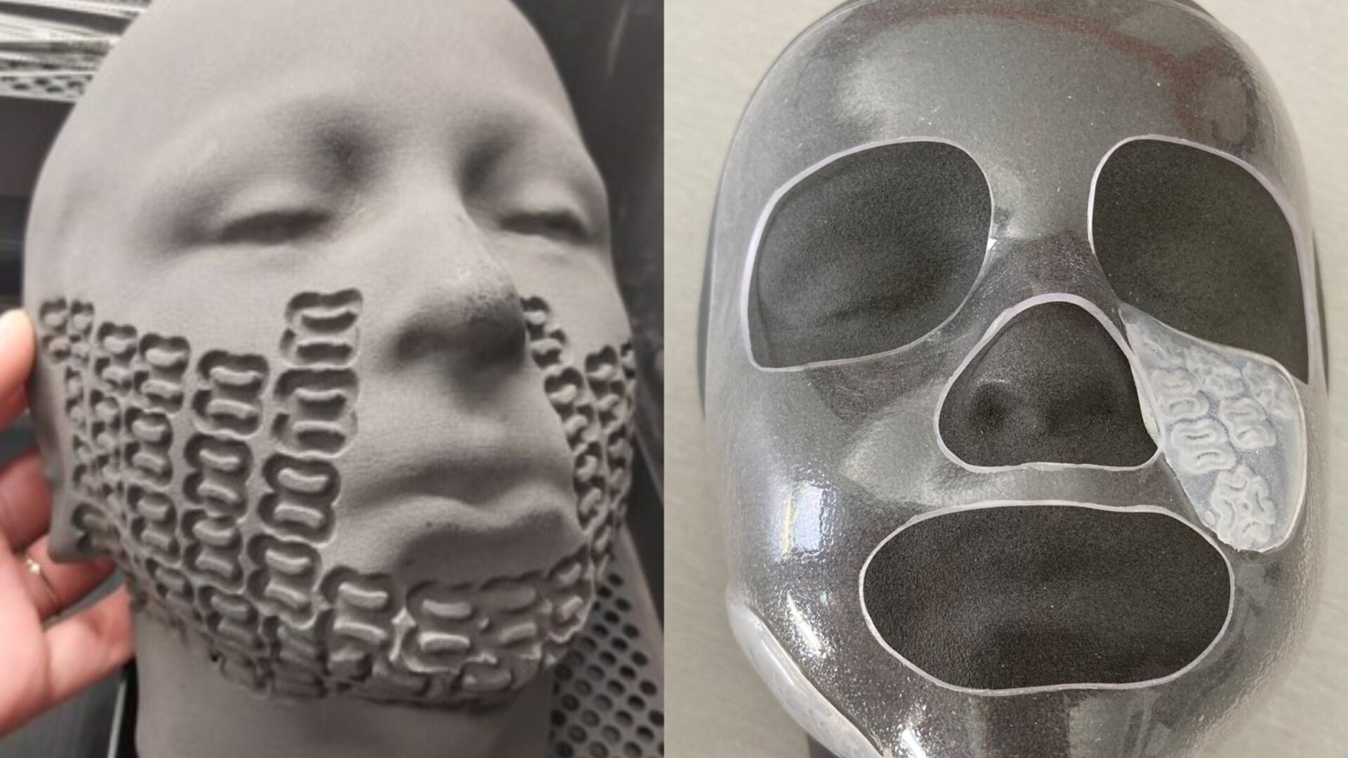 Le innovative maschere facciali 3D per le ustioni dei bambini
