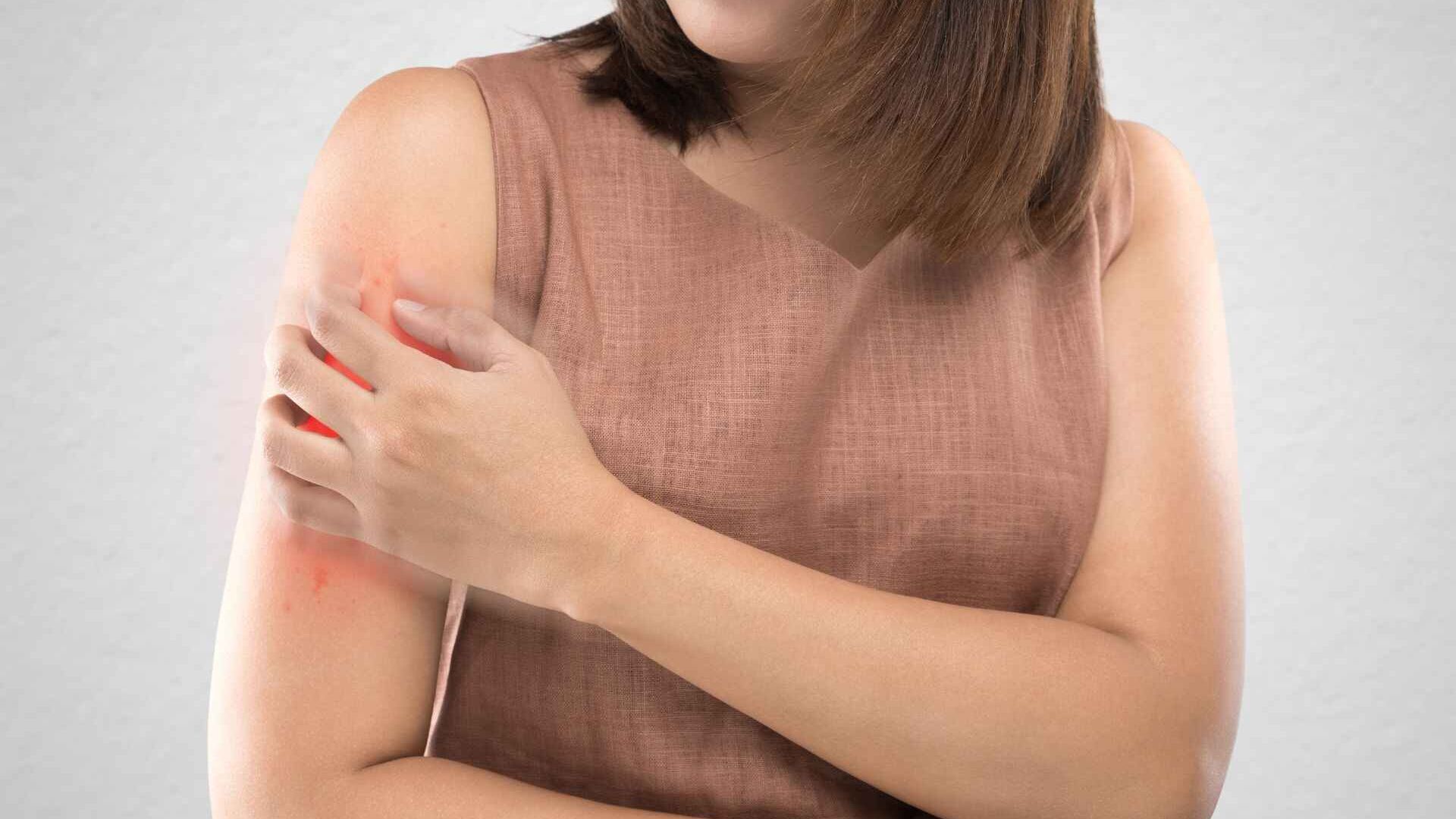 Dermatite: la pelle è in grado di riflettere eventuali disturbi del metabolismo