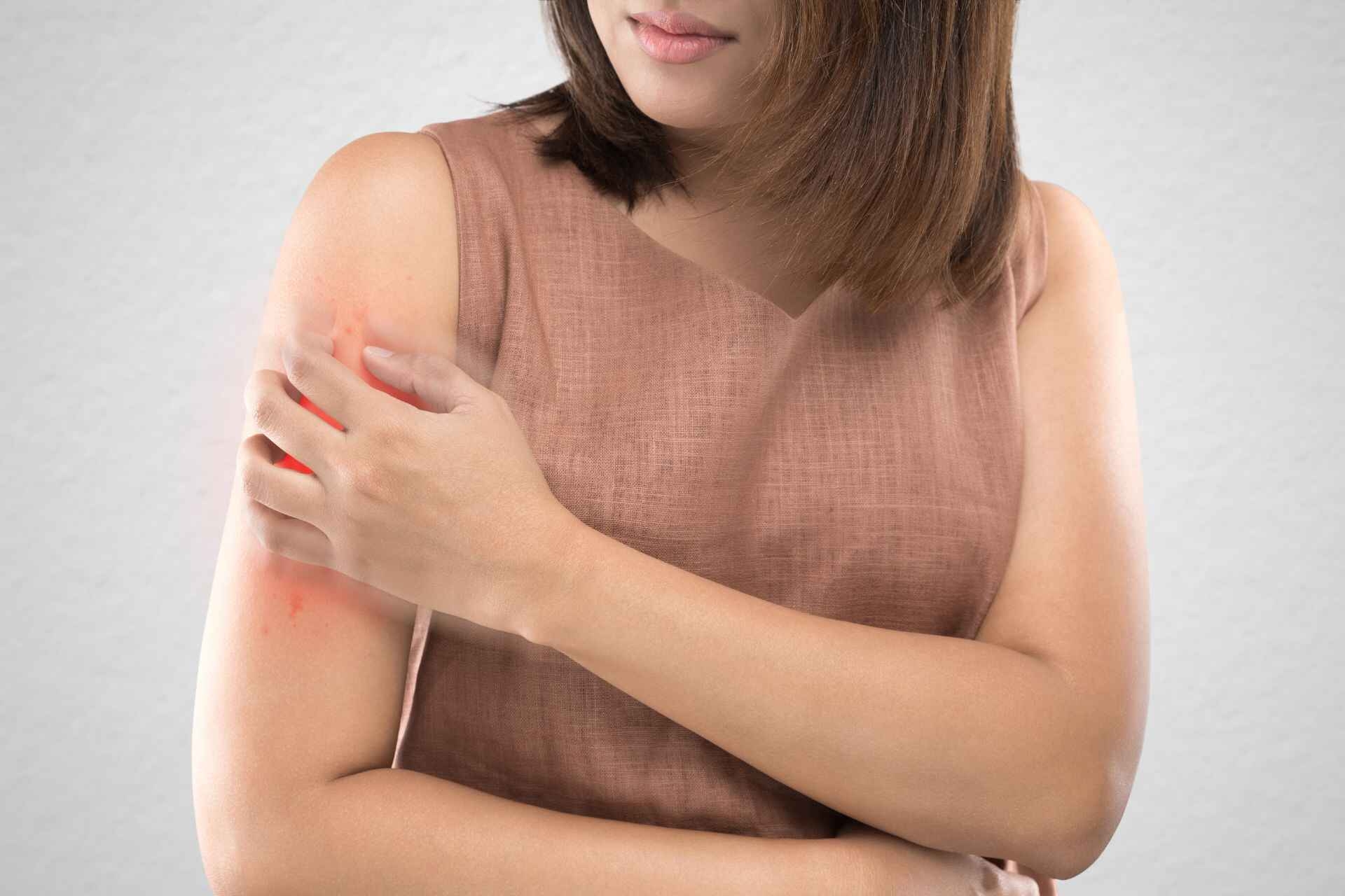 Dermatite: la pelle è in grado di riflettere eventuali disturbi del metabolismo