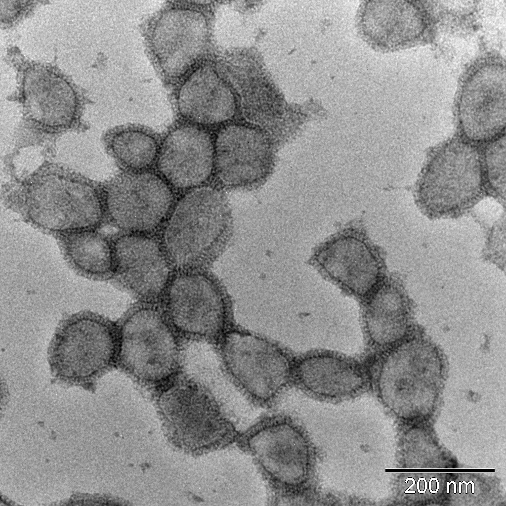 Morte dei virus: un virus fotografato e rappresentato con le misure delle particelle