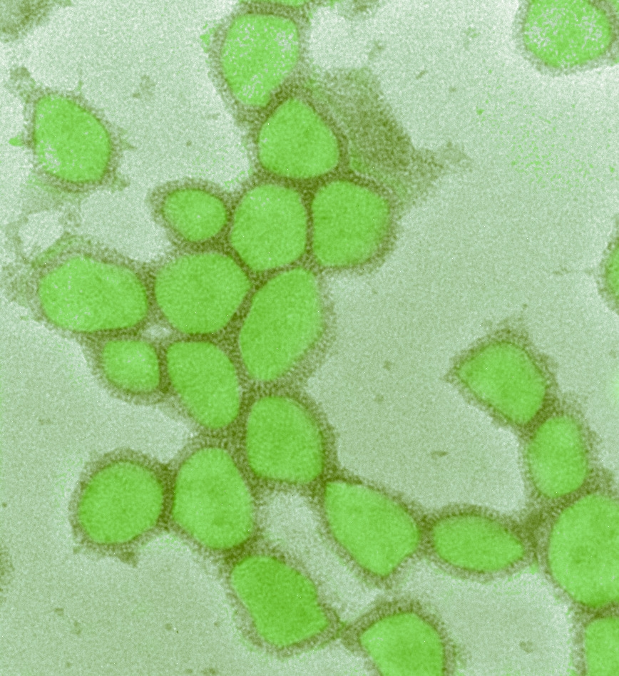 Morte dei virus: un virus fotografato e rappresentato in verde nell'ambito di uno studio sulle mascherine (Foto: EMPA)