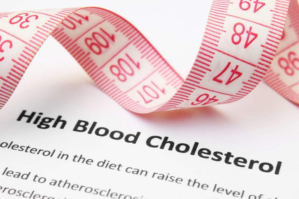 Colesterolo: l’ipercolesterolemia è un problema purtroppo molto comune, ma può essere curata