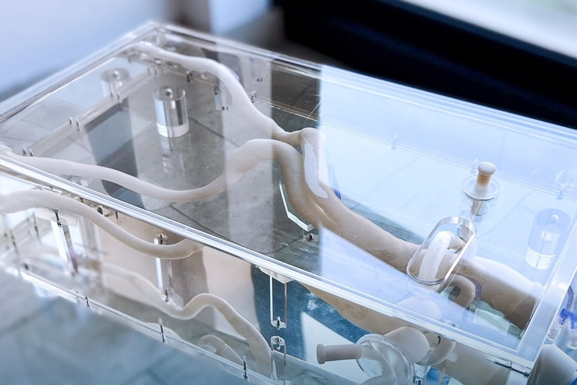 Simulatore aortico:il simulatore aortico di un aneurisma nell’area del pancreas realizzato con stampa in 3D dal gruppo SolidWorld Group, l’Ospedale San Giovanni di Dio di Firenze e dall’Università degli Studi di Milano