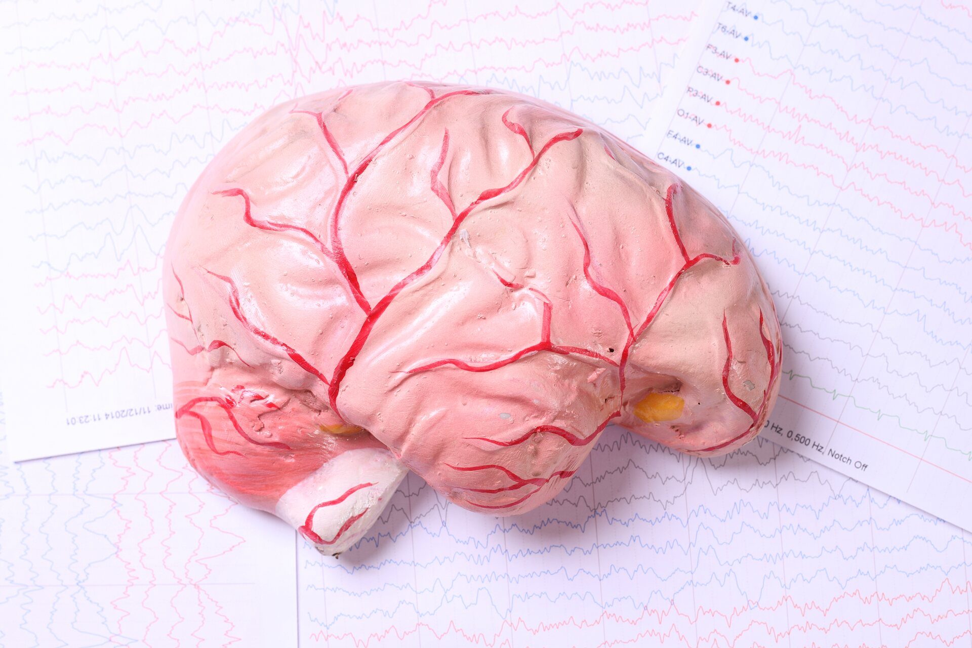 Cervello umano: il cervello è l'organo principale del sistema nervoso centrale di un animale ed è parte dell’encefalo