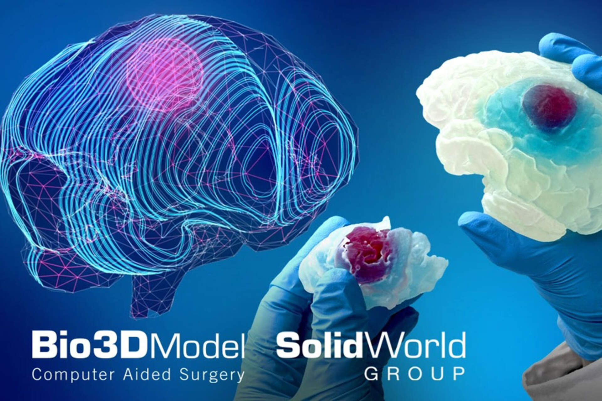 Cervello umano: una key visual del cervello affetto da tumore stampato in 3D dal SolidWorld Group