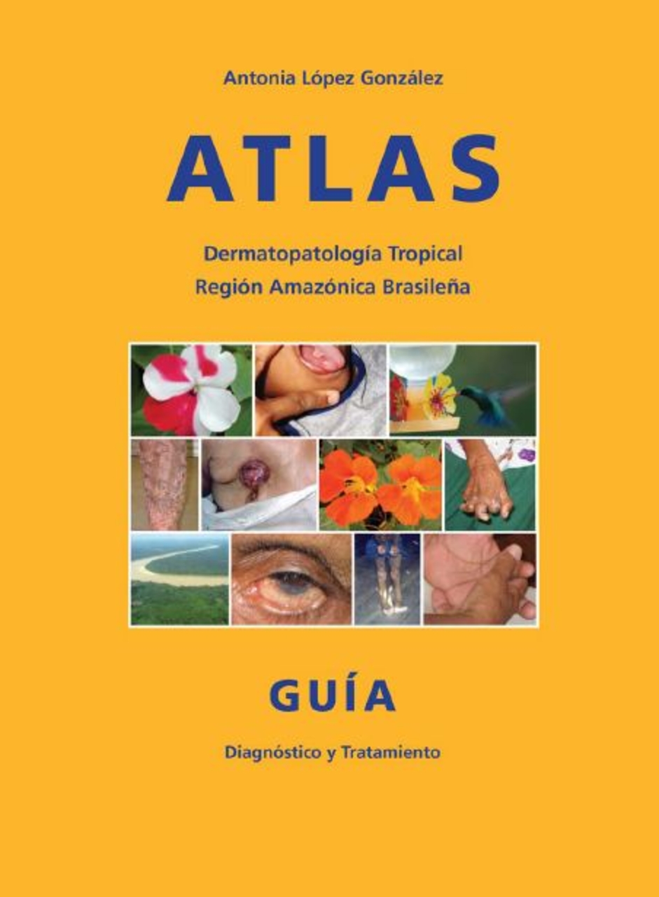 Sztuczna inteligencja: Antonia López González jest autorką książki „Atlas de Dermatopatología Tropical”, otwartej na wiedzę brazylijskich szamanów