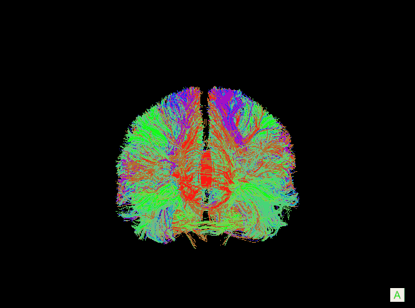 Cervello: i segnali cerebrali vengono inviati da una fonte a un bersaglio, stabilendo un percorso polisinaptico che interseca più regioni del cervello 