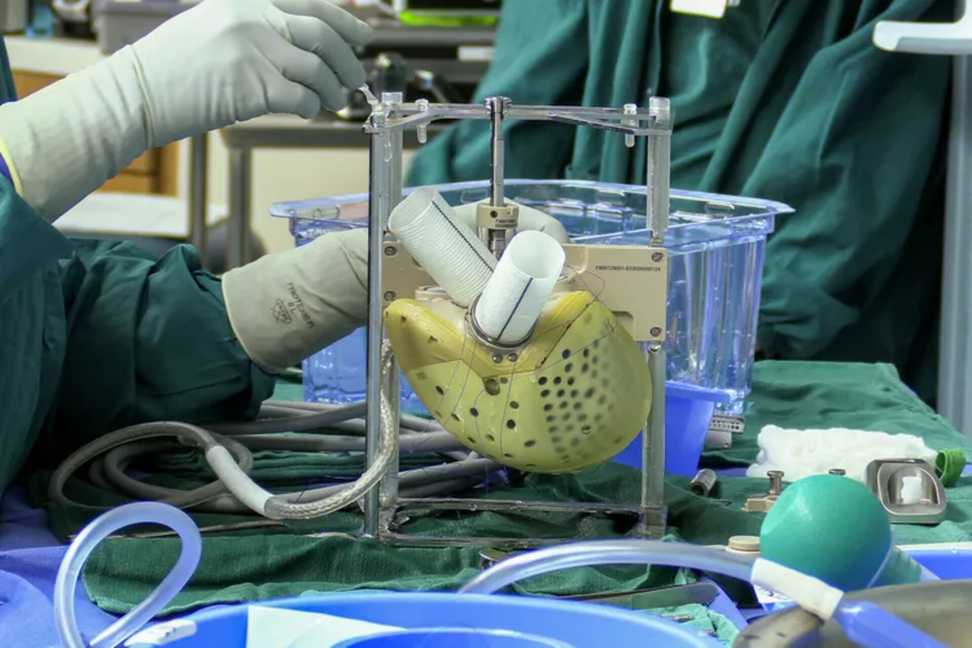 Kunstigt hjerte: Aeson-bioprotesen fra det franske firma Carmat