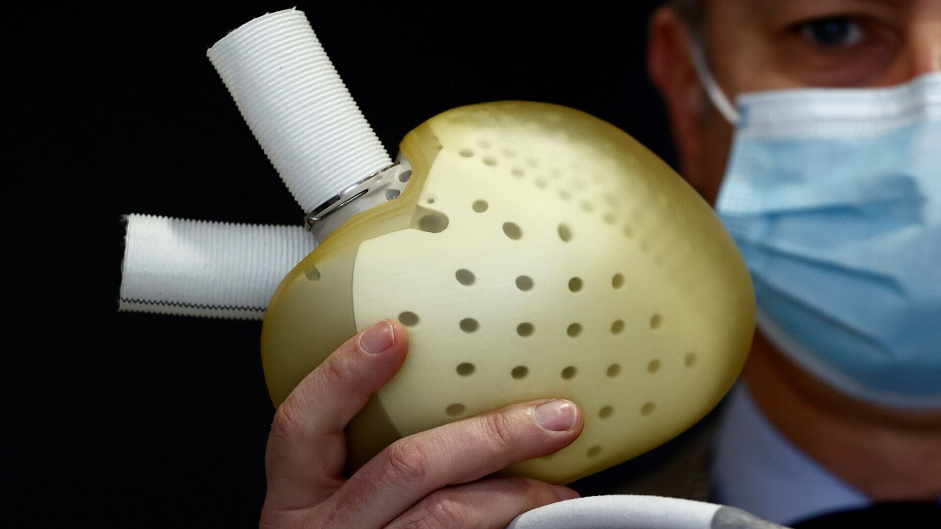 Konstgjort hjärta: Aeson-bioprotesen från det franska företaget Carmat