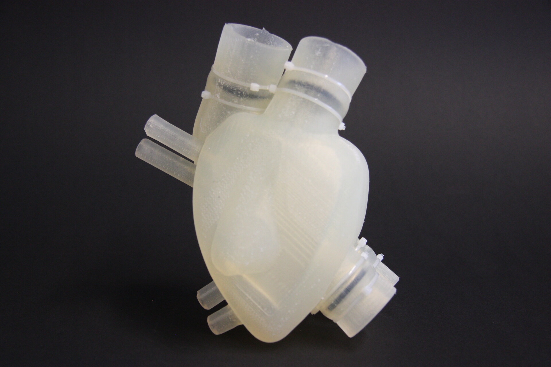 Gino Gerosa: interview with the surgeon from the University of Padua who will coordinate doctors, engineers, biologists and materials experts with a 50 million euro budget to create the first Italian artificial heart